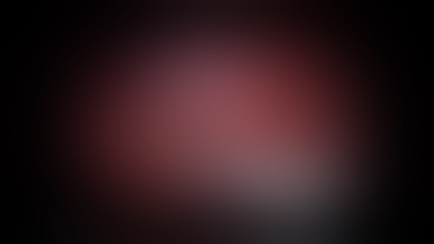 Robotic Low Anterior Colon Resection