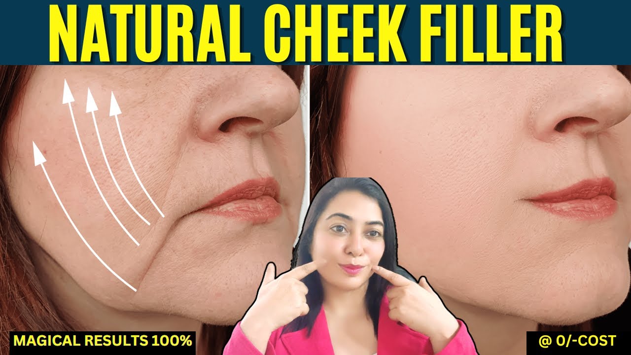 Natural Cheek Filler-A million times stronger than Botox, eliminates ...