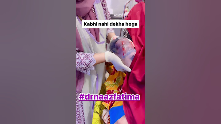 best normal delivery by dr naaz fatima #drnaazfatima #baby #youtubeshorts