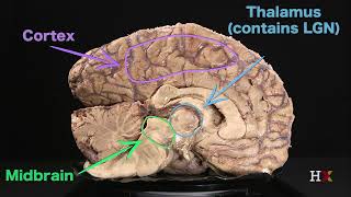 The Lateral Geniculate Nucleus #3.10