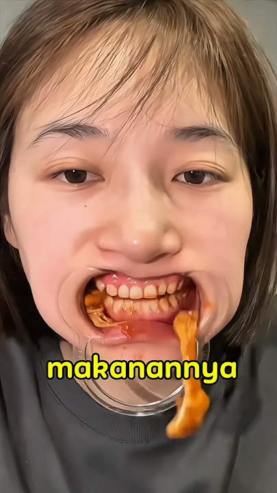 Karena Sariawan Cewek Ini Susah Makan #shortviral #viralvideo #lucu