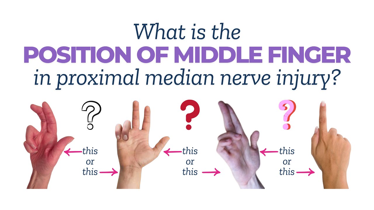 Position of middle finger in case of proximal median nerve injury or ...