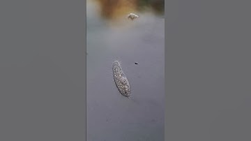 microscopy video - ciliate hypotrich