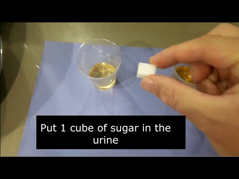 SUGAR PREGNANCY TEST