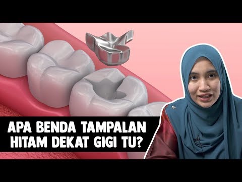 Video: Tampalan Nikotin - Harga, Ulasan, Petunjuk