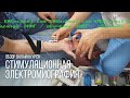 Обзор онлайн курса по стимуляционной ЭНМГ Школы Электромиографии EMGschool