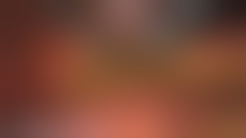 LapSim Appendectomy: Optional Stapling