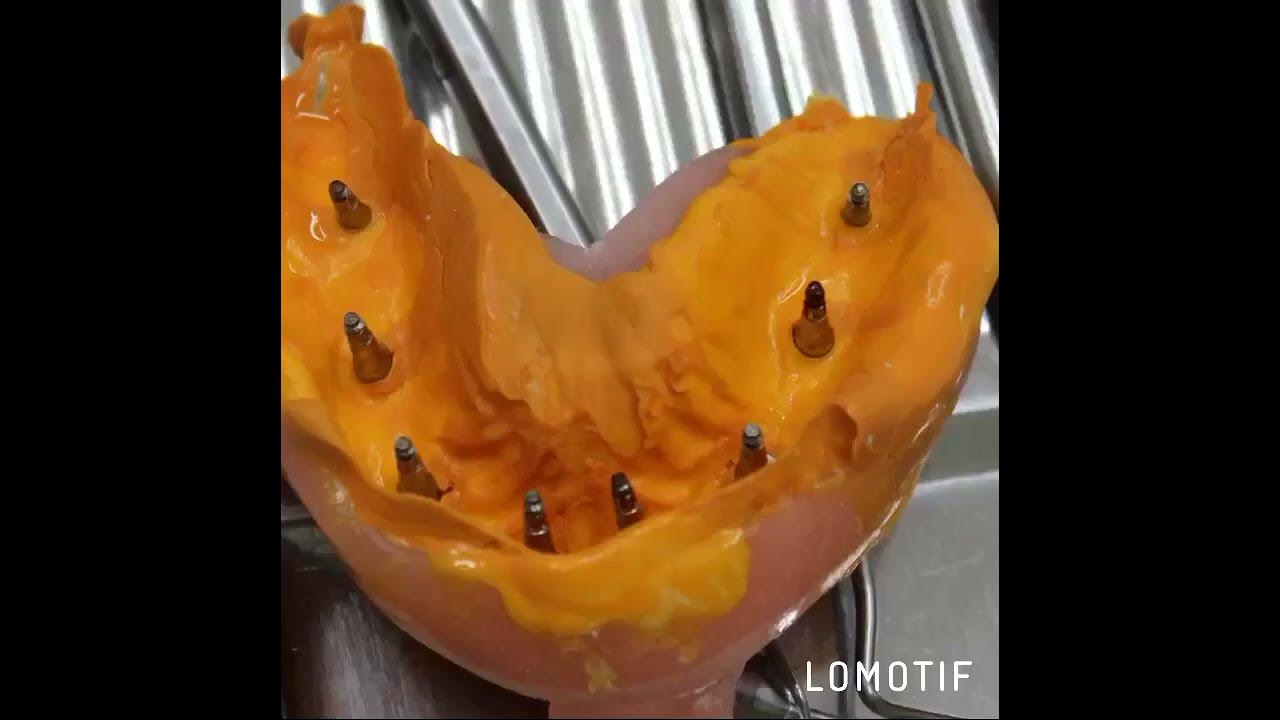 dental-house-youtube