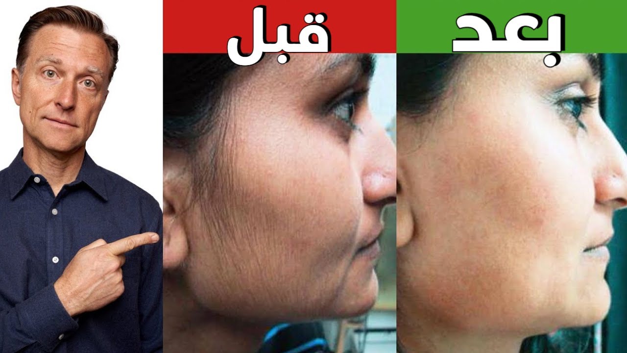 أفضل طريقة للتخلص من شعر الوجه بشكل نهائي دون رجعة لدى الإناث