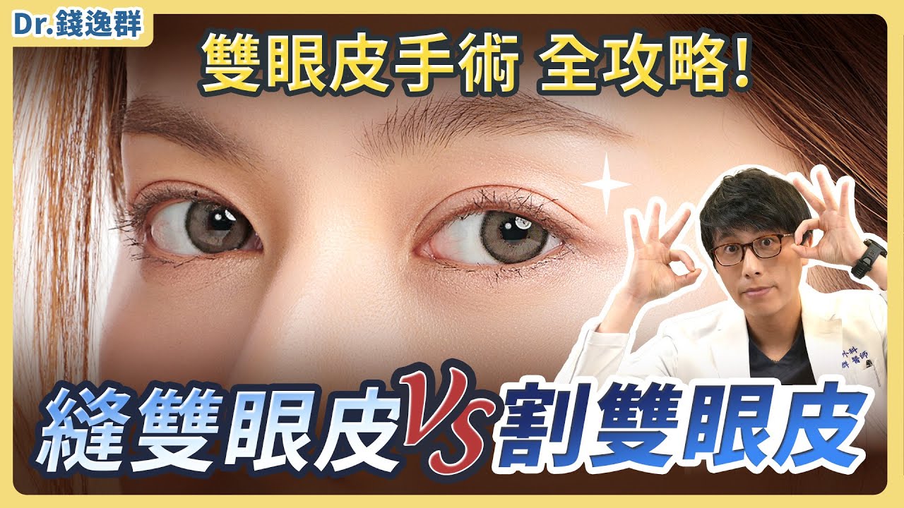 縫雙眼皮 vs 割雙眼皮： 優缺點、持久度、恢復期 一次搞懂！ 雙眼皮手術全攻略 | feat. 整形外科 錢逸群 醫師