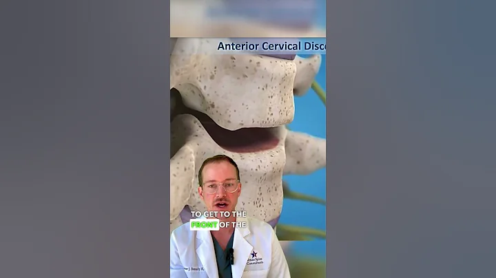 𝐍𝐞𝐜𝐤 𝐅𝐮𝐬𝐢𝐨𝐧 𝐒𝐮𝐫𝐠𝐞𝐫𝐲 (𝐀𝐧 𝐀𝐂𝐃𝐅!)✅