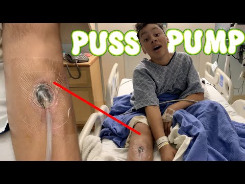 Puss Pump | Hospital Day 3