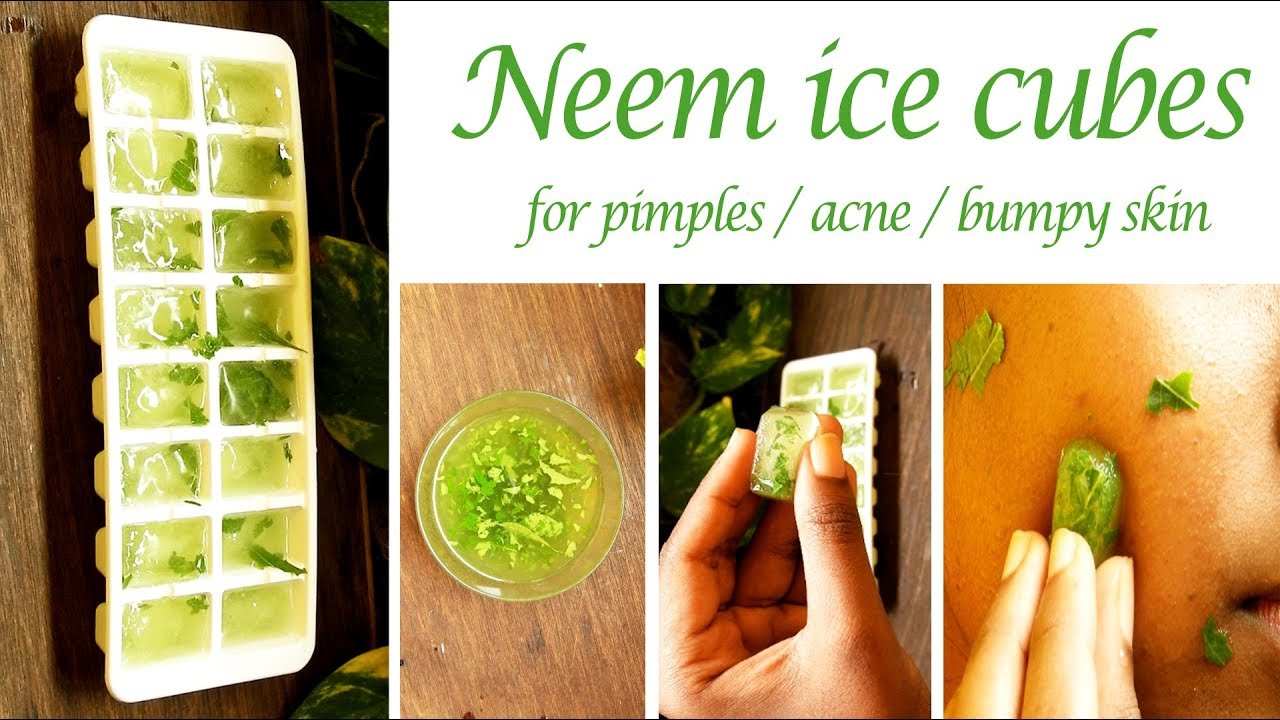 Rub this to get rid of pimples/acne / bumpy skin quickly | Neem ice cubes for face