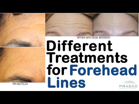 How Forehead Lines and Wrinkles can be Treated With or Without Surgery