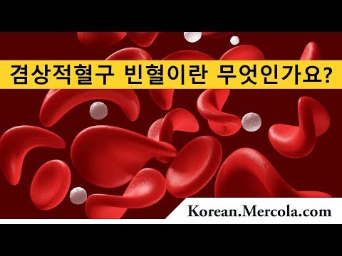 겸상적혈구 빈혈이란 무엇인가요?