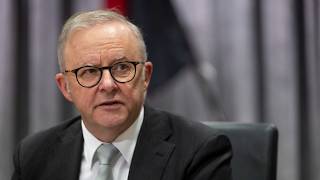Albanese government chose controversial census sex and gender topics