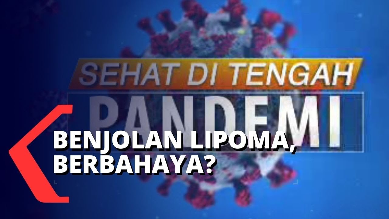 Sehat di Tengah Pandemi: Mengenal Lipoma dan Cara Mengatasinya!