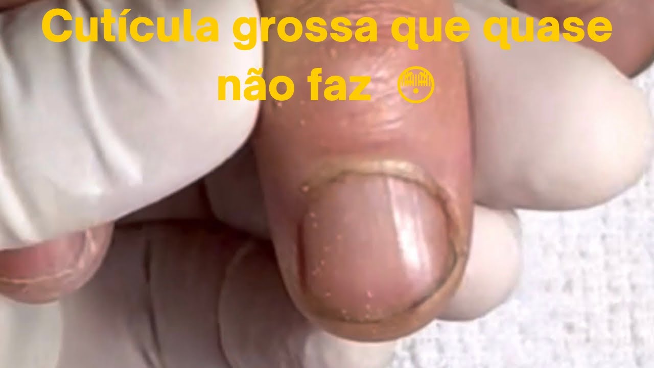 Cutícula grossa , grudada é que demora pra fazer. Veja como vai ficar!
