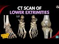 CT Scan of Lower Extremities Techniques | Tutorial-56 | CT Ankle and Foot | CT Knee Joint | Filming