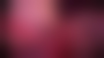 Laparoscopic spleen preserving distal pancreatectomy - step-by-step