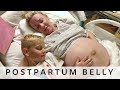 My Quint Postpartum Belly - Life is a Gift