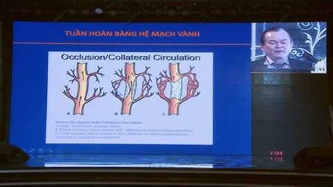 Các thuốc kiểm soát nhịp tim có lợi ích giống nhau ? - TS.BS. Tôn Thất Minh