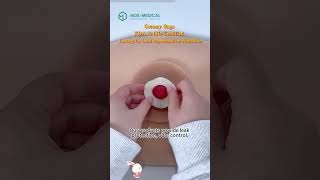 Ostomy Bags FDA & ISO Certified Looking for Local Representatives Worldwide