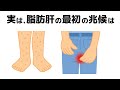誰かに話したくなる「脂肪肝」と健康の雑学