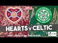 Hearts v Celtic live stream and TV details plus preview for top of the table Premiership clash