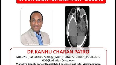 PRACTICAL DEMONSTRATION OF CT_MR FUSION IN RADIATION PLANNING