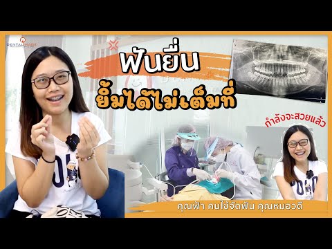 รีวิวจัดฟัน