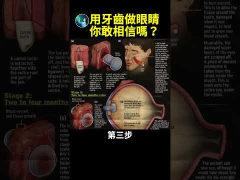 用牙齿做眼睛 你敢相信吗？