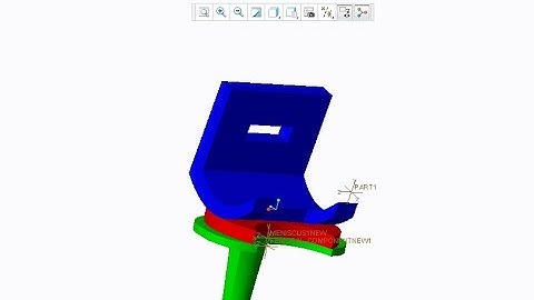 FEA simulation of Prosthesis Artificial Knee joint FOR PROSTHETIC LIMB for cartilage damage inANSYS