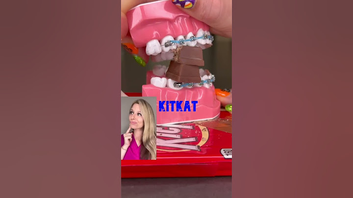 CANDY YOU CAN'T EAT WITH BRACES 🍭 🍬