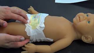 How To Improve Breathing For Pigeon Chest Pectus Carinatum