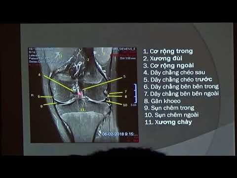 Video GIẢI PHẪU - HÌNH ẢNH CỘNG HƯỞNG TỪ KHỚP GỐI (BS. Võ... - youtube