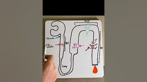 Diuretics in under 2 mins!