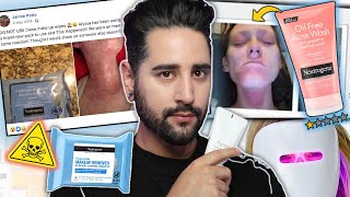 The Makeup Wipes That Caused 'Chemical Burns' - The Neutrogena Lawsuit - When Beauty Turns Ugly