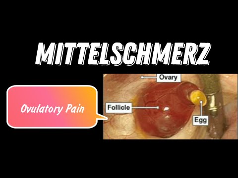 Mittel-Schmerz | Ovulatory Pain | Mid-cycle Pain  || Mis.Medicine