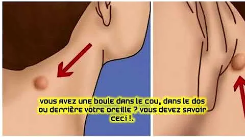 Pourquoi J Ai Un Bouton Derriere L Oreille
