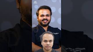 ഒരു ഹെയർ ട്രാൻസ്പ്ലാന്റ് സർജൻ തന്റെ സ്വന്തം മുടി മാറ്റിവെക്കൽ ശസ്ത്രക്രിയയ്ക്കായി തിരഞ്ഞെടുത്തത് ...