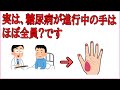 【誰かに教えたくなる健康雑学】実は糖尿病が進行中の手、ほぼ全員〇〇です---興味深い事実