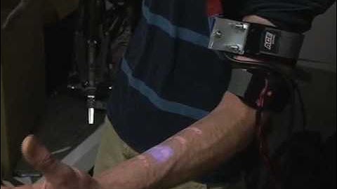 Skin Touchscreen Keyboard "Skinput": Appropriating the Body as an Input Surface