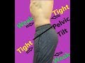 Anterior Pelvic Tilt-30 Day Correction Plan