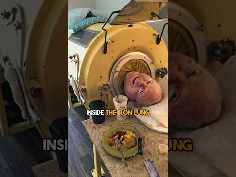 This Man Has Lived Inside the Iron Lung Machine for 65 Years!