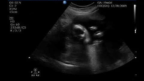 Gina LaBarbera's 19 week ultrasound