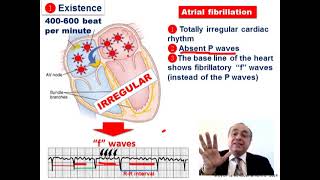 ECG Quick Review [Part 2]    #usmle #internal_medicine #cme #medicaleducation #ecg # محاضرات_باطنة screenshot 5