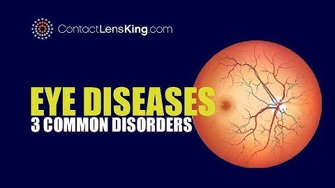Eye Diseases | 3 Common Eye Conditions