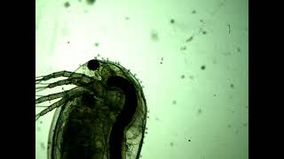 Ciliates Living On A Daphnia