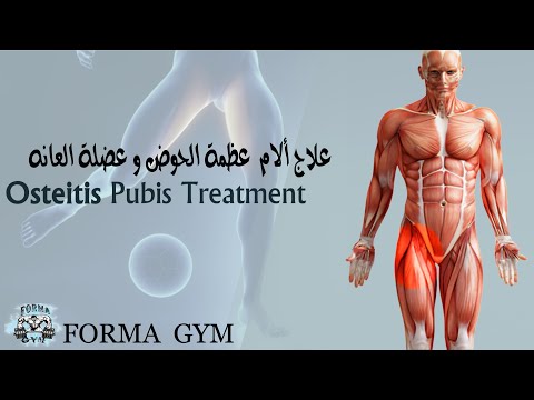 علاج عظمة الحوض وعضلة العانه Osteitis Pubis Treatment